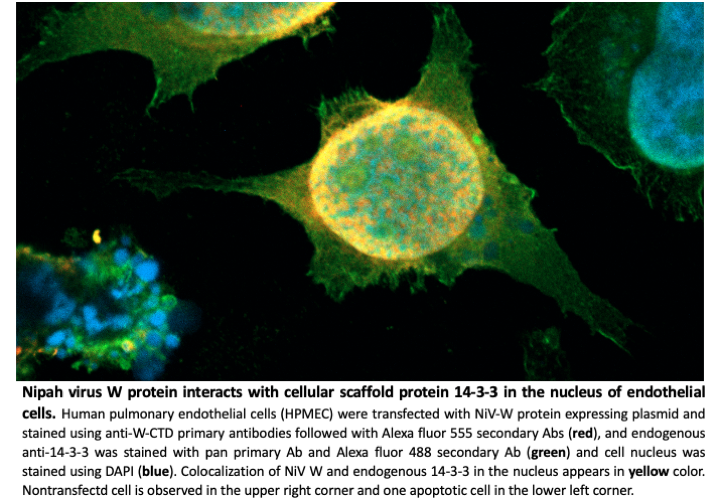 Nipah virus W protein harnesses nuclear 14-3-3 to inhibit NF-κB-induced proinflammatory response 