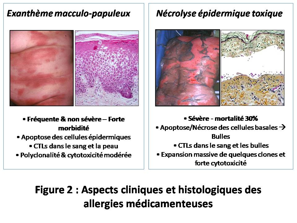 Presentation De L Equipe Centre International De Recherche En Infectiologie