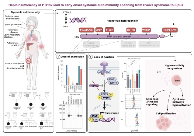 Haploinsufficiency in PTPN2 leads to early-onset systemic autoimmunity from Evans syndrome to lupus