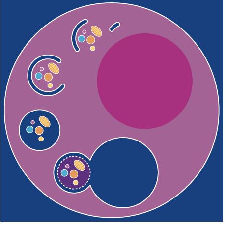 LACC1-associated JIA linked to autophagy defects in macrophages